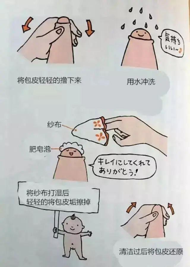 最新割包皮技術(shù)，小巷深處的醫(yī)療奧秘探索